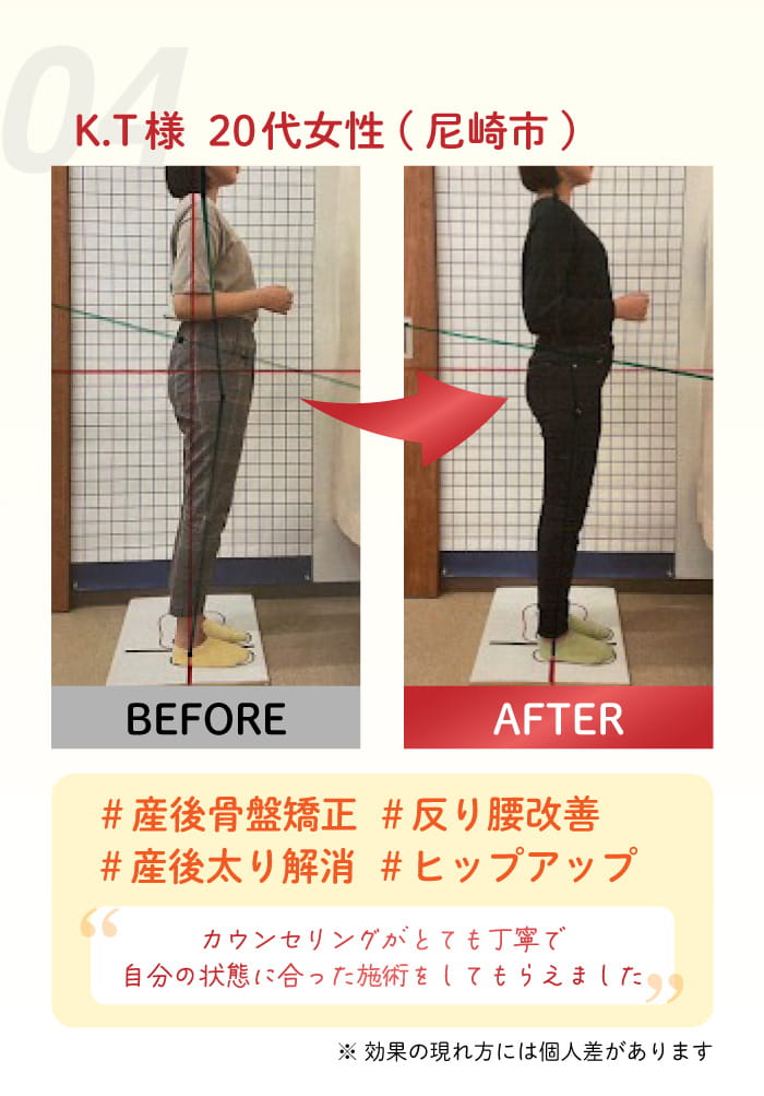 04：K. T 様 20 代女性(尼崎市) #産後骨盤矯正 #反り腰改善。#産後太り解消 #ヒップアップ カウンセリングが、とても丁寧て。自分の状態は合った施術をしてもリえました！